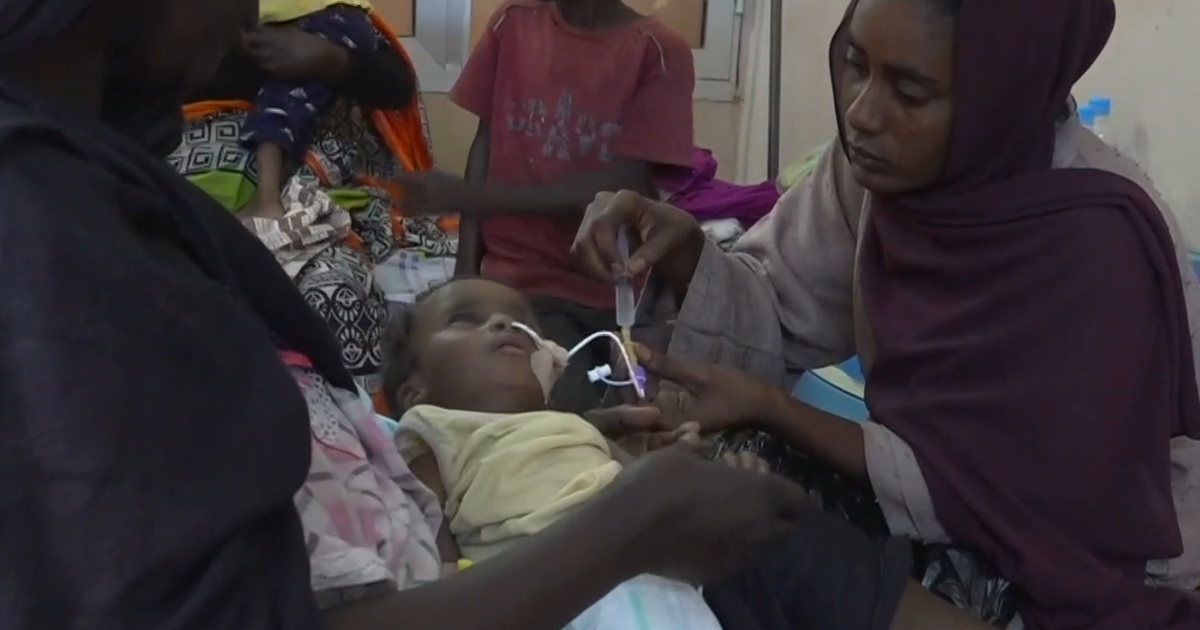 Sudan'ın iç savaşı binlerce çocuğa açlıktan ölüyor. Yardım işçileri, Trump'ın yardım dondurmasına daha fazla hayata mal olabileceğini söylüyor.