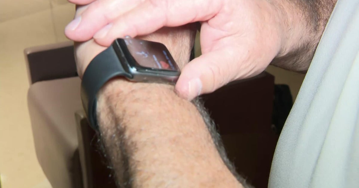 Smartwatch alerts Florida man to dangerous heart condition Smartwatch alerts Florida man to dangerous heart condition