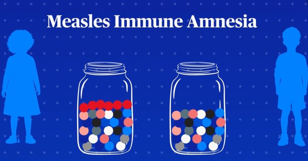 Doctor explains how the measles virus affects the immune system