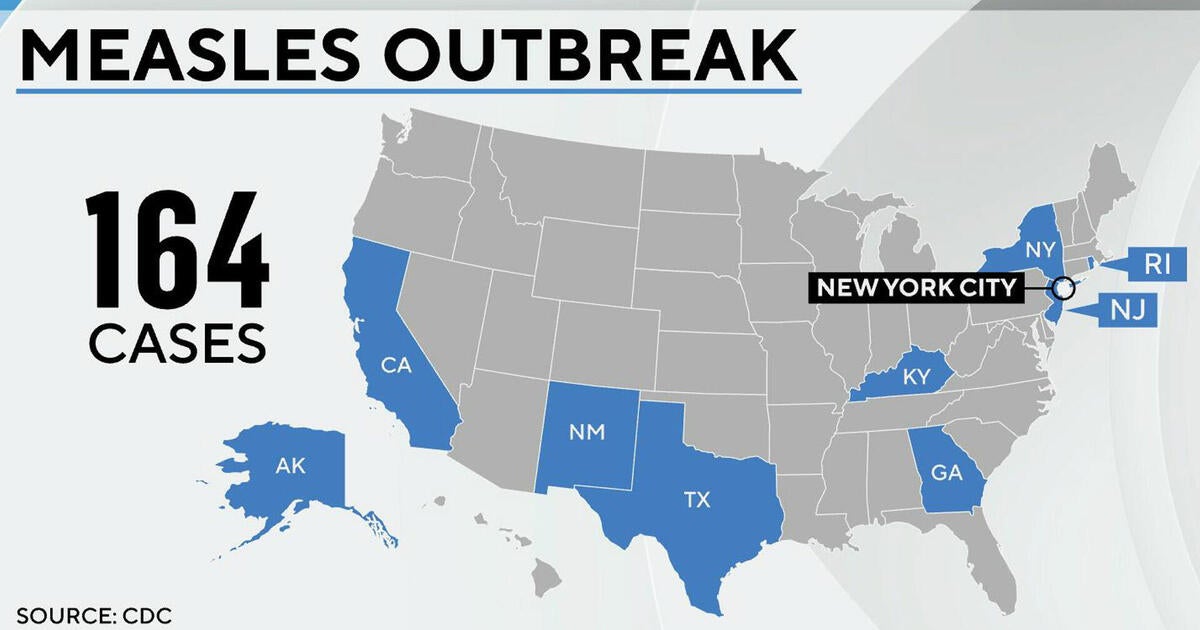 Measles outbreak spreads as experts warn of lasting immune effects