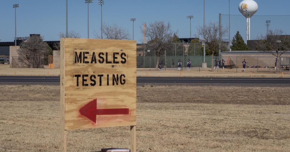 Texas doctor describes treating measles outbreak in Gaines County