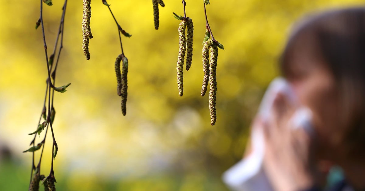 Spring allergies are here for 2025, and this map shows which U.S. cities could be hit hardest