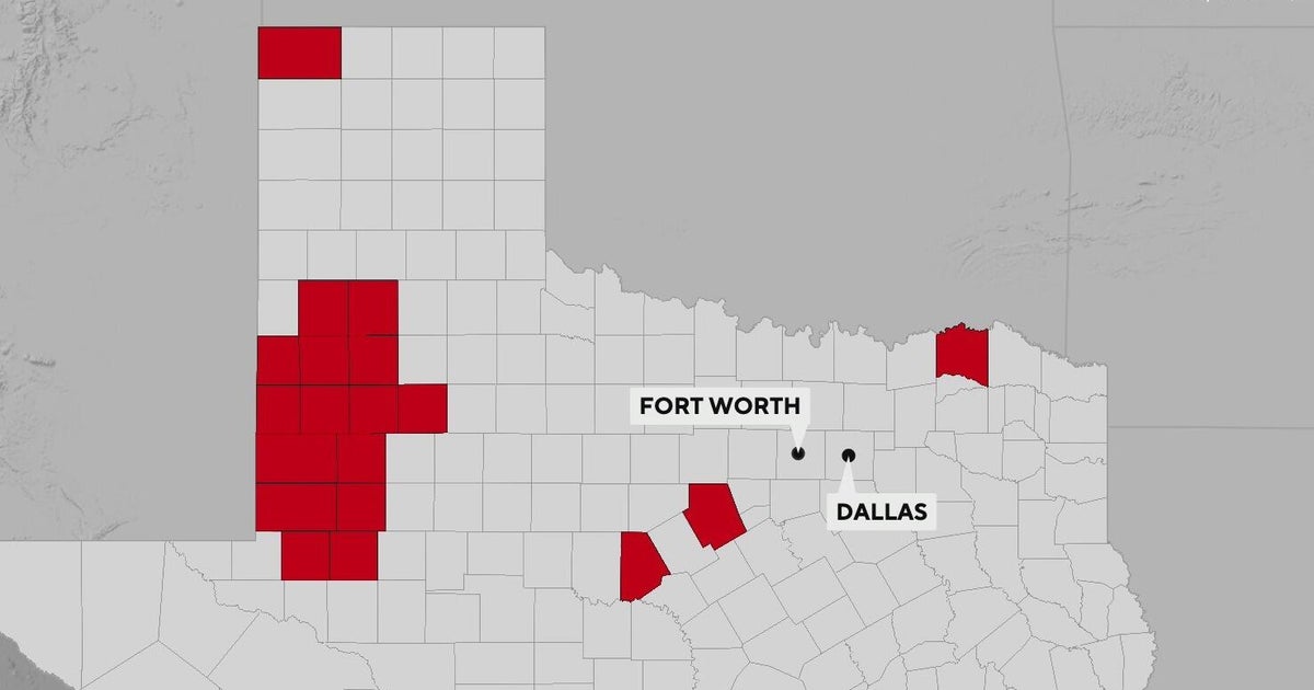 Measles cases increase to 422 across Texas - CBS Texas