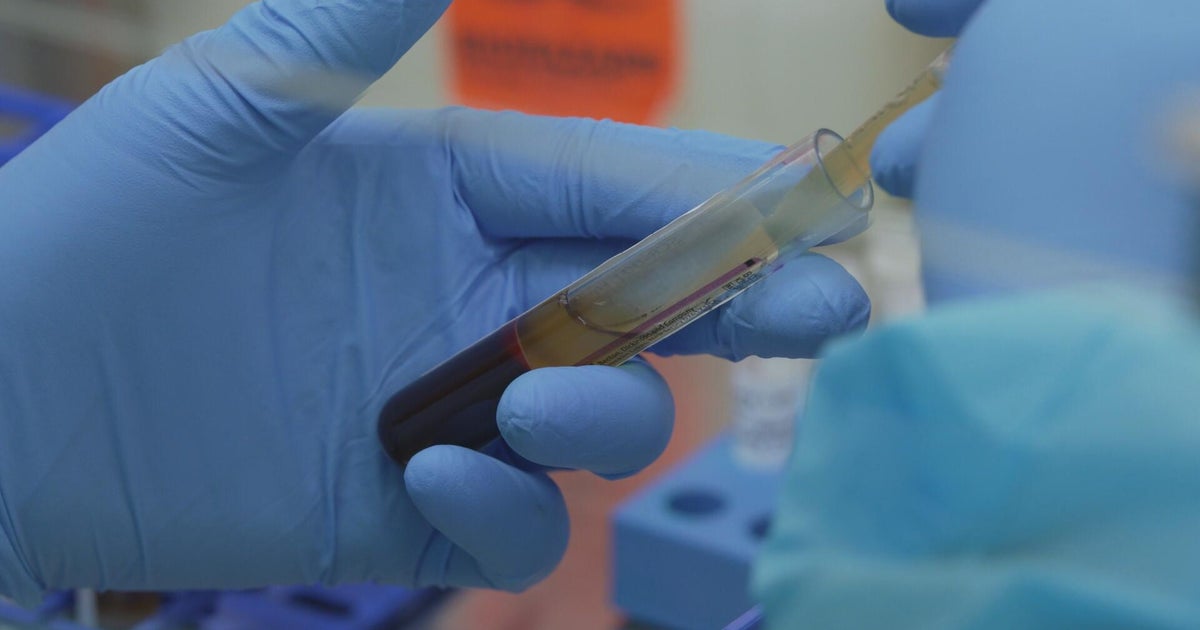 How cuts at the National Institutes of Health could impact Americans’ health How cuts at the National Institutes of Health could impact Americans’ health