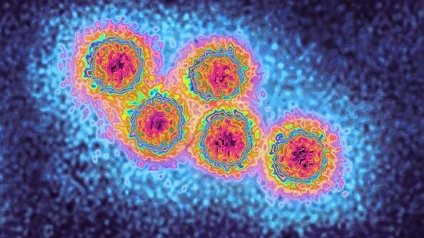 Hepatitis a virus 