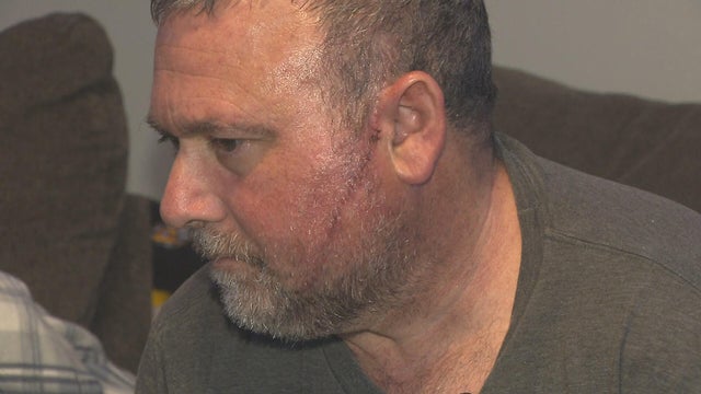 Boston hospital attack 