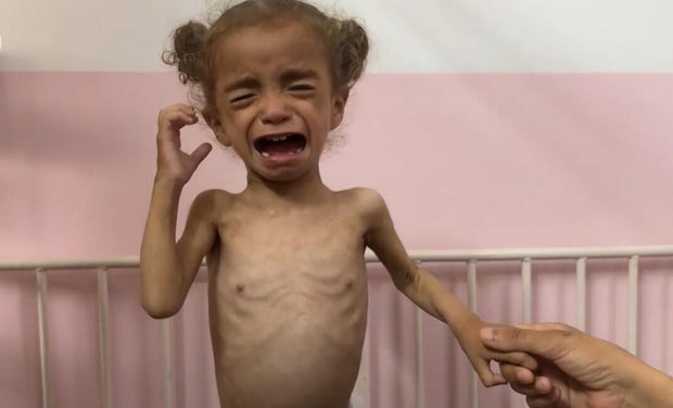Gaza-starvation-cbs-may-2025.jpg 