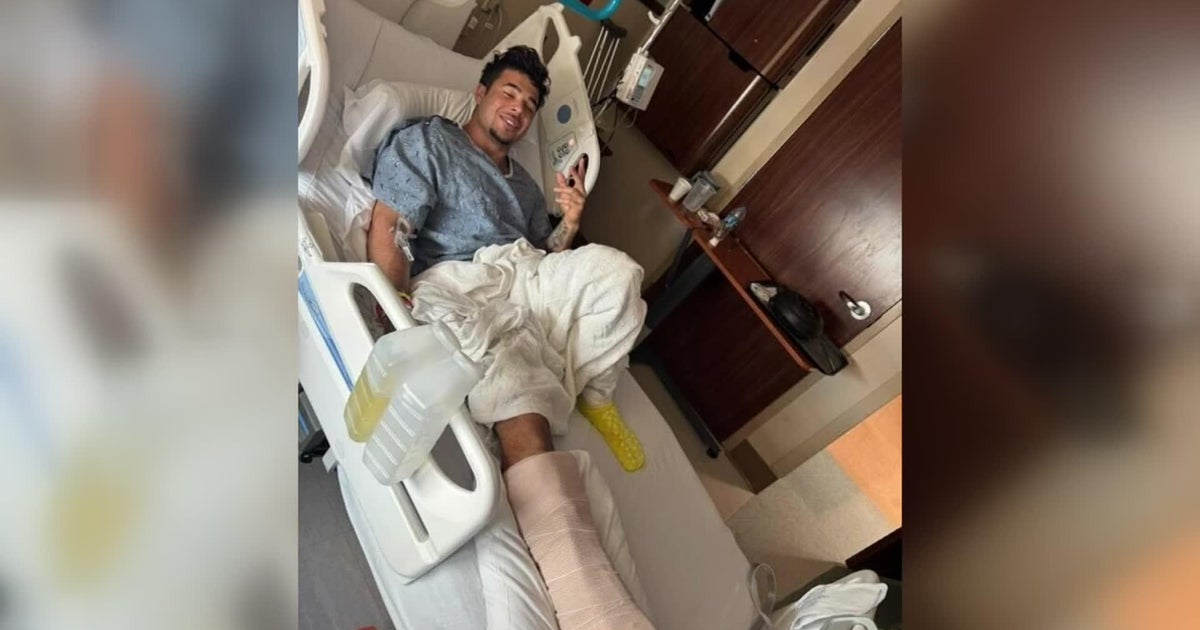 Victim speaks out after alleged attacker’s high-rise escape attempt in Edgewater, police say
