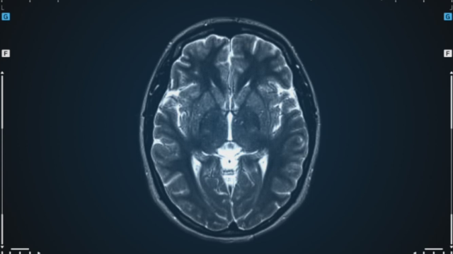 New framework for assessing traumatic brain injuries 