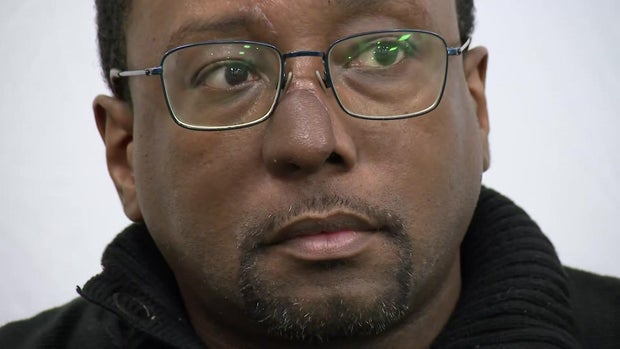 Long Island man with 3D-printed nose 