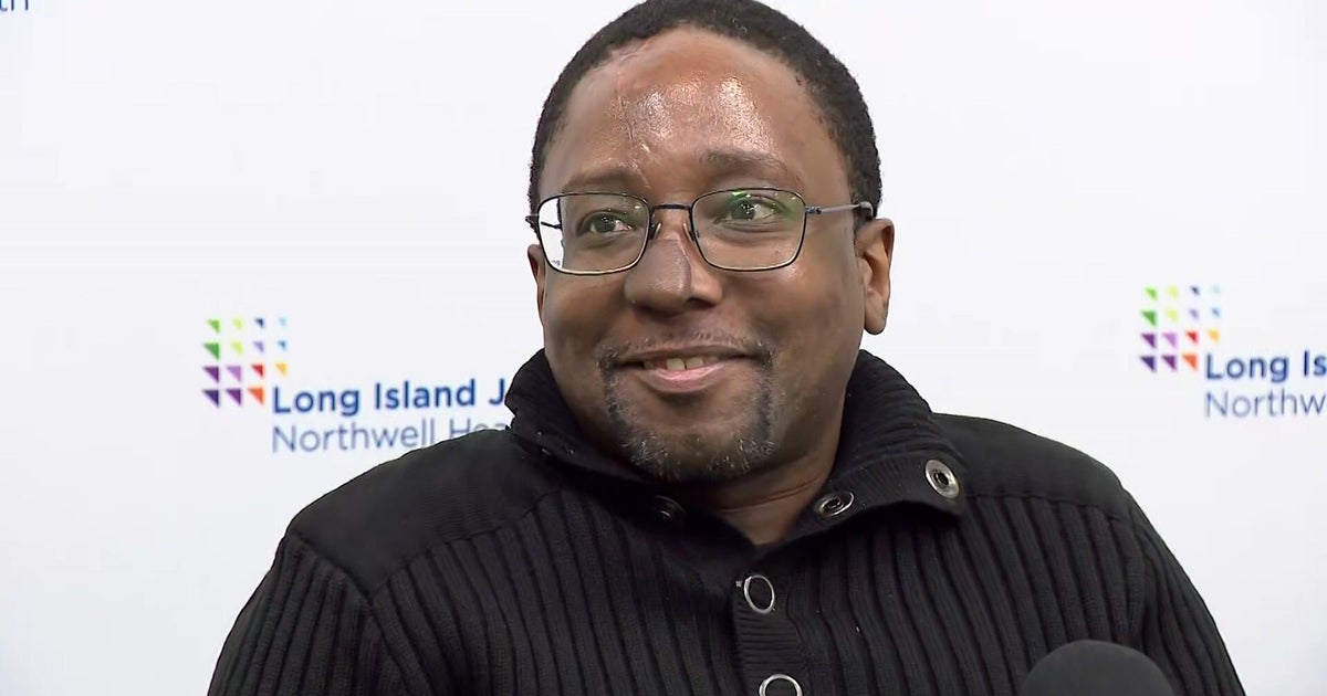 Long Island Man's Nose Rebuilt Using 3D Surgery After Attack