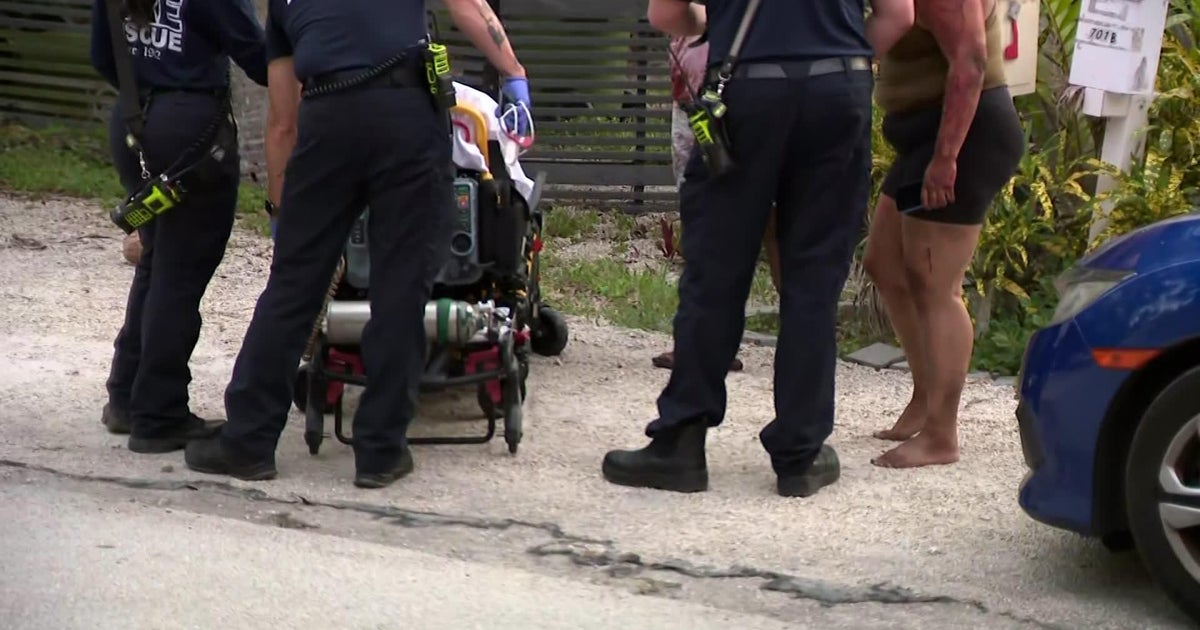 Broward Animal Control officer injured in dog attack, expected to survive, FLPD confirms