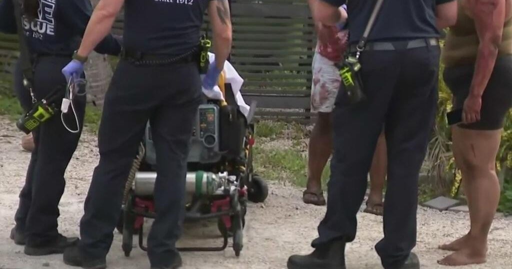 911 call released after dog attack in Fort Lauderdale - CBS Miami