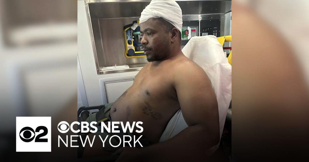 Victim speaks out after being attacked with pipe on bus in the Bronx ...