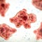 Brain-eating amoeba kills woman who used tap water for sinus rinse