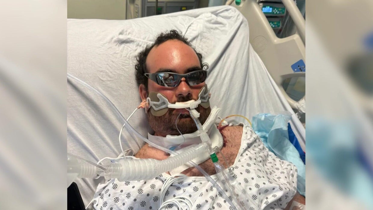 2 cyclists injured after running into kite string on NYC bridge - CBS ...