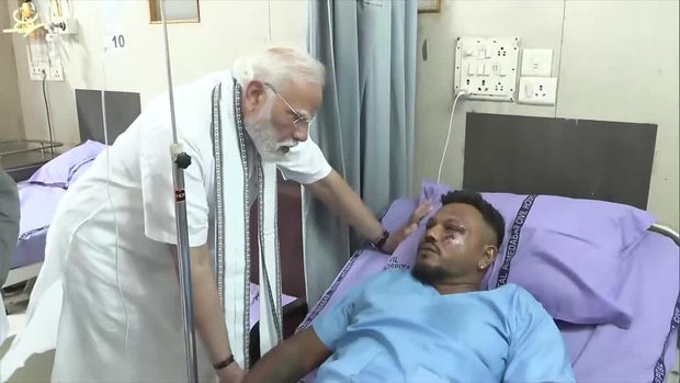 Air India survivor in the hospital 