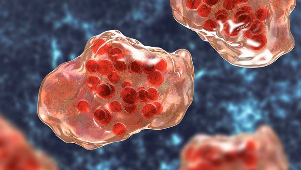Measles outbreak declared in Delaware after 2 additional cases reported