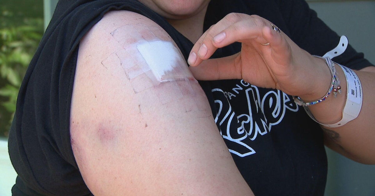 Aurora police investigate after woman struck by stray bullet while in bed 
