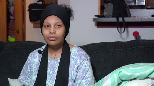 5p-pkg-stp-woman-shot-wcco83rm.jpg 