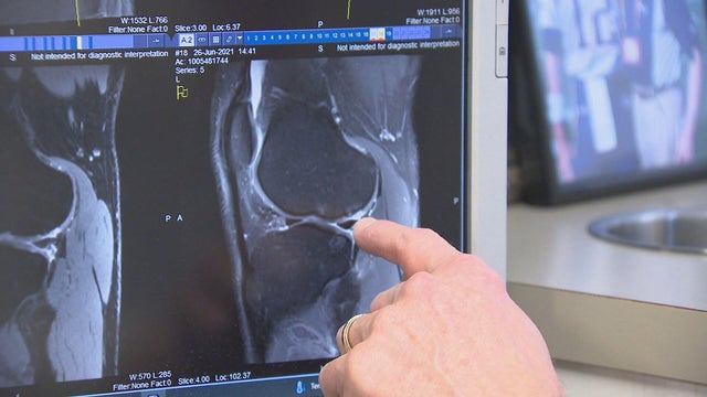 knee-cartilage.jpg 