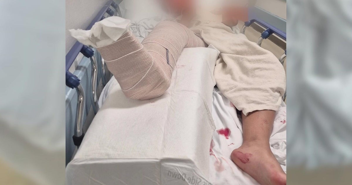 Teen out of hospital after stray bullet shooting near NYC's Stonewall Inn 