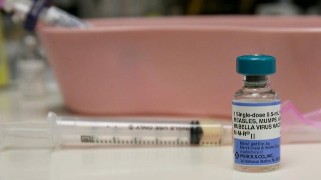 measles.jpg 