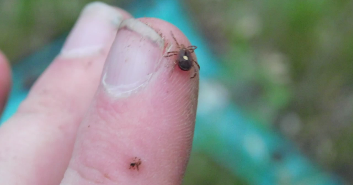 Chicago area doctors expect more hospital visits from tick bites this summer 