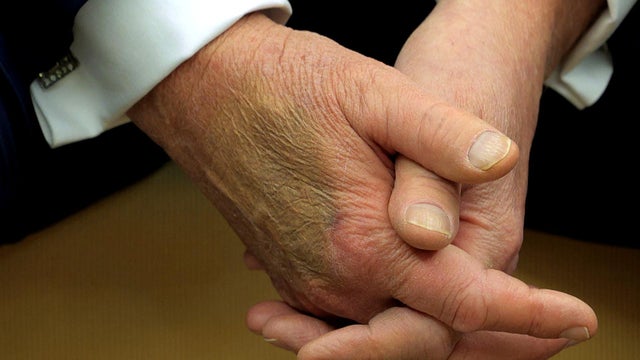 00-placeholder-thumb.jpg 