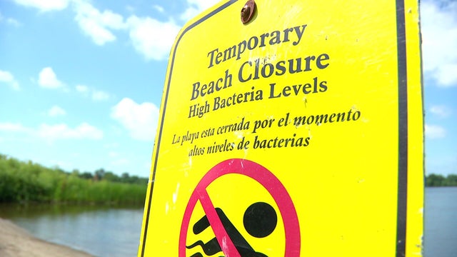 5p-pkg-e-coli-beaches-closed-wcco8blt.jpg 