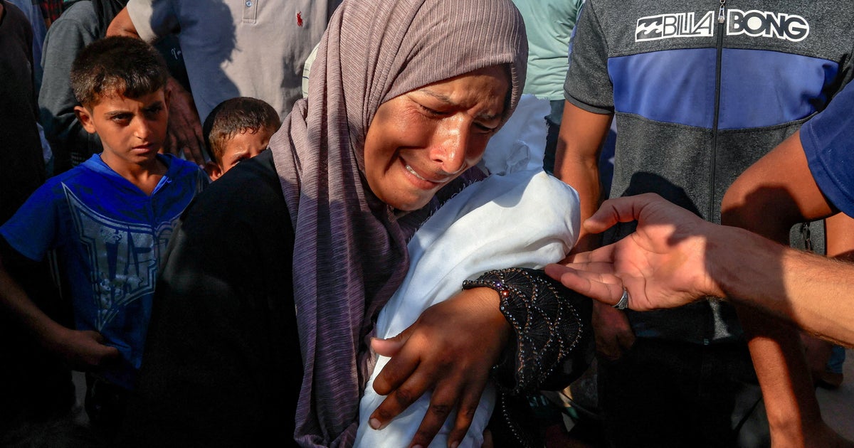 Hospital chief says 21 Gazan children died of malnutrition in 3 days