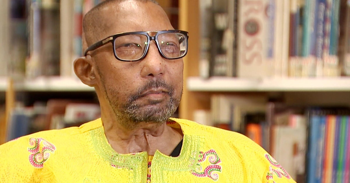 Robert Chelsea, first Black patient to receive a full face transplant, shares his story 