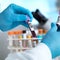 How one small clinic proves hepatitis C doesn't have to be an epidemic