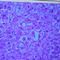 How nanoplastics may be impacting our long-term health