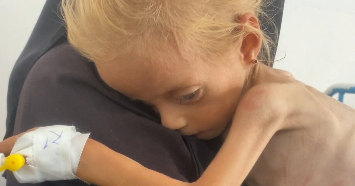 Netanyahu denies starvation in Gaza as images of emaciated children spark global outcry