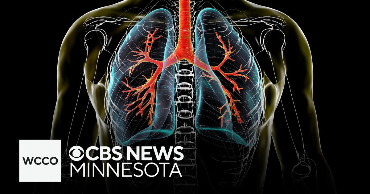 What Breathing In Too Much Wildfire Smoke Can Do To Your Lungs CBS 