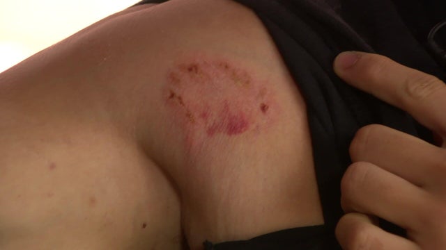 6p-pkg-restaurant-worker-attacked-wcco8e6l-00-01-1204.jpg 