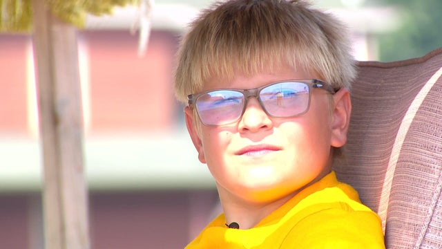 10p-pkg-farm-eye-injury-recovery-wcco8e4w.jpg 