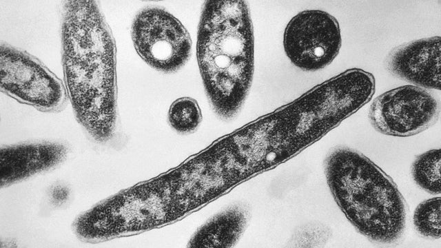 Poland Legionnaires Disease 