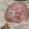 5-week-old baby fighting for life after contracting tick-borne illness