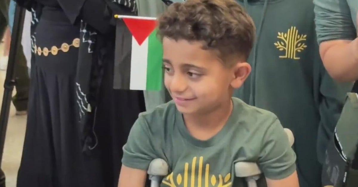 Injured children from Gaza arrive in Bay Area to get medical treatment 