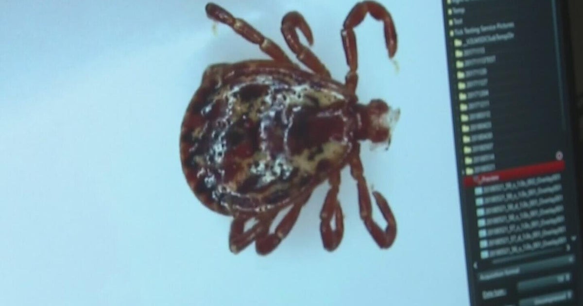 California is seeing spike in tick-borne illness anaplasmosis, experts warn 