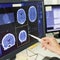 New study finds link between traumatic brain injuries and brain cancer risk