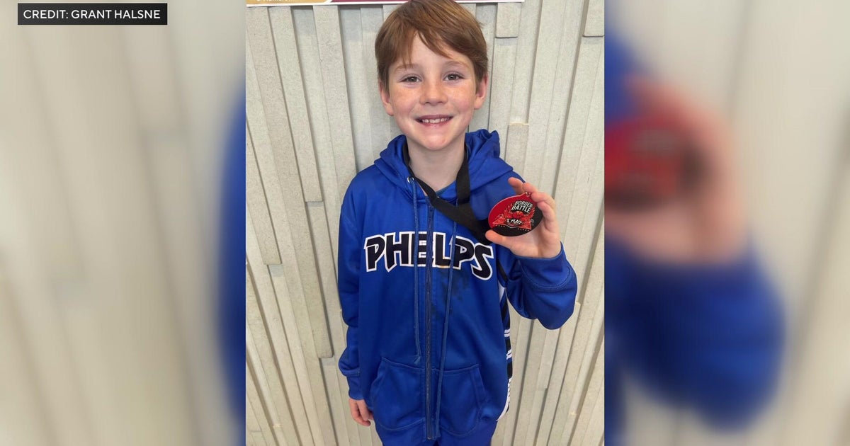 Surgery set for Annunciation shooting survivor with bullet fragment in neck