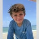 Doctors detail shark attack injuries suffered by 8-year-old boy off Key Largo 