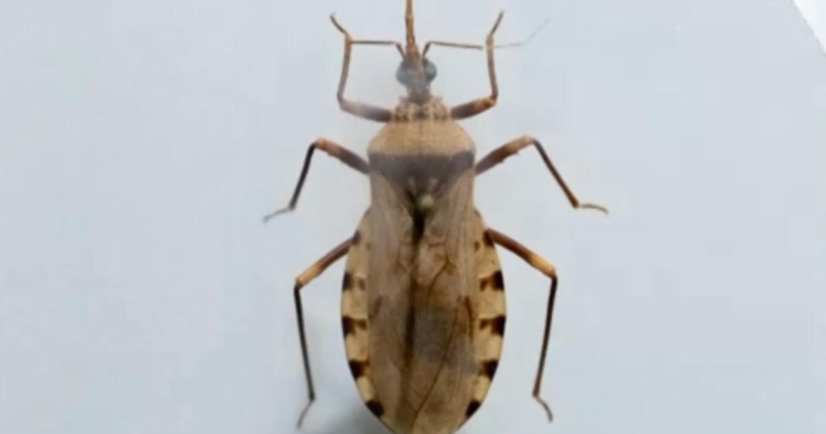 Potentially deadly Chagas disease from "kissing bugs" seemingly spreading across U.S.