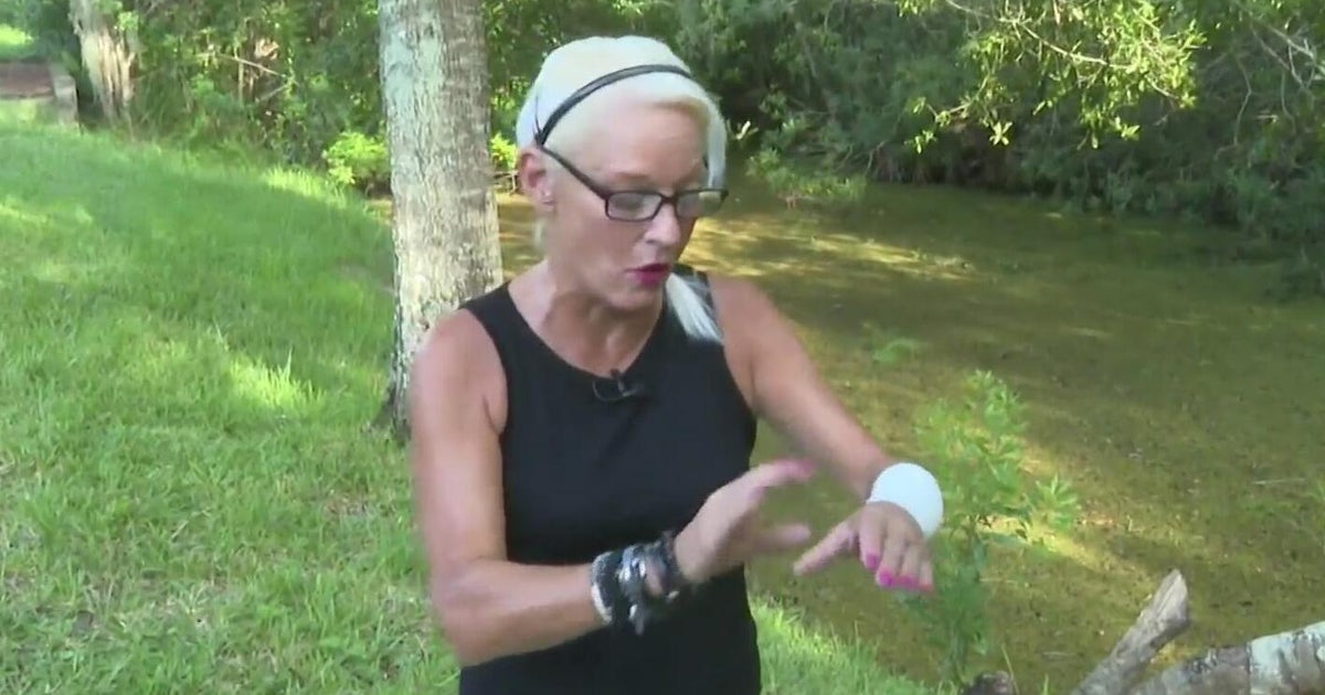 Florida Woman Fights Off 5-Foot Alligator to Rescue Puppy in Land O’Lakes