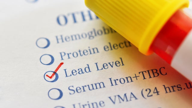 Lead level test 