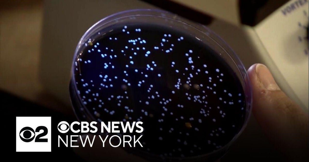 NYC Health Commissioner Warns: Federal Budget Cuts Could Worsen Legionnaires' Disease Outbreaks
