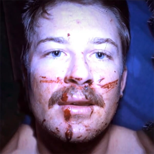 Gary-Wright-Injuries.jpg 